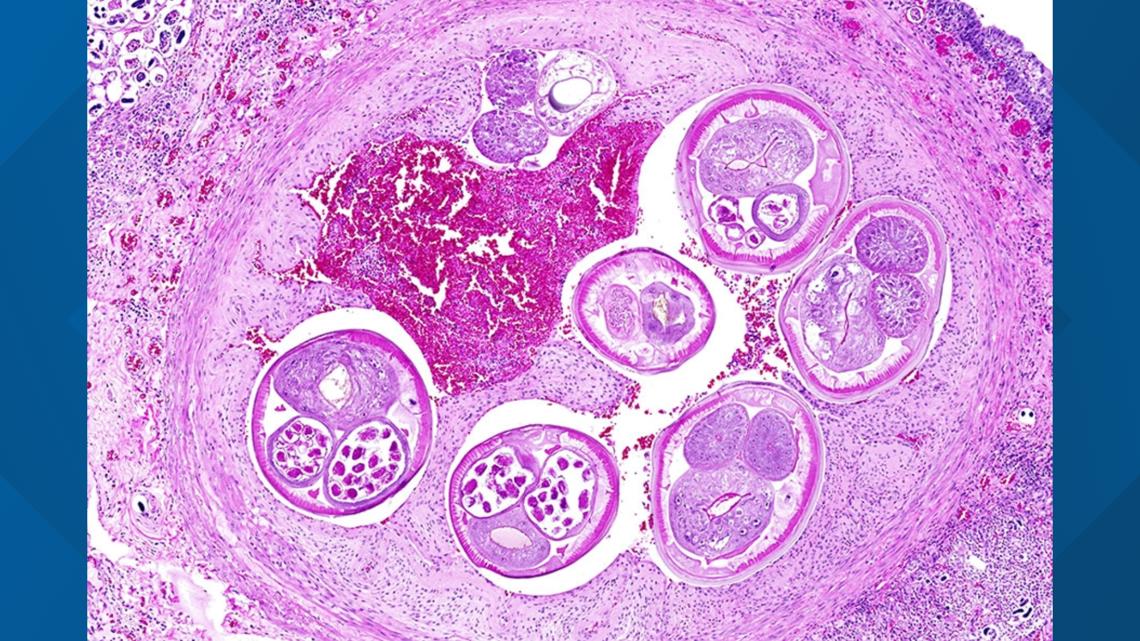 Brain-infecting worms, known as 'rat lungworm,' detected west of Texas for the first time