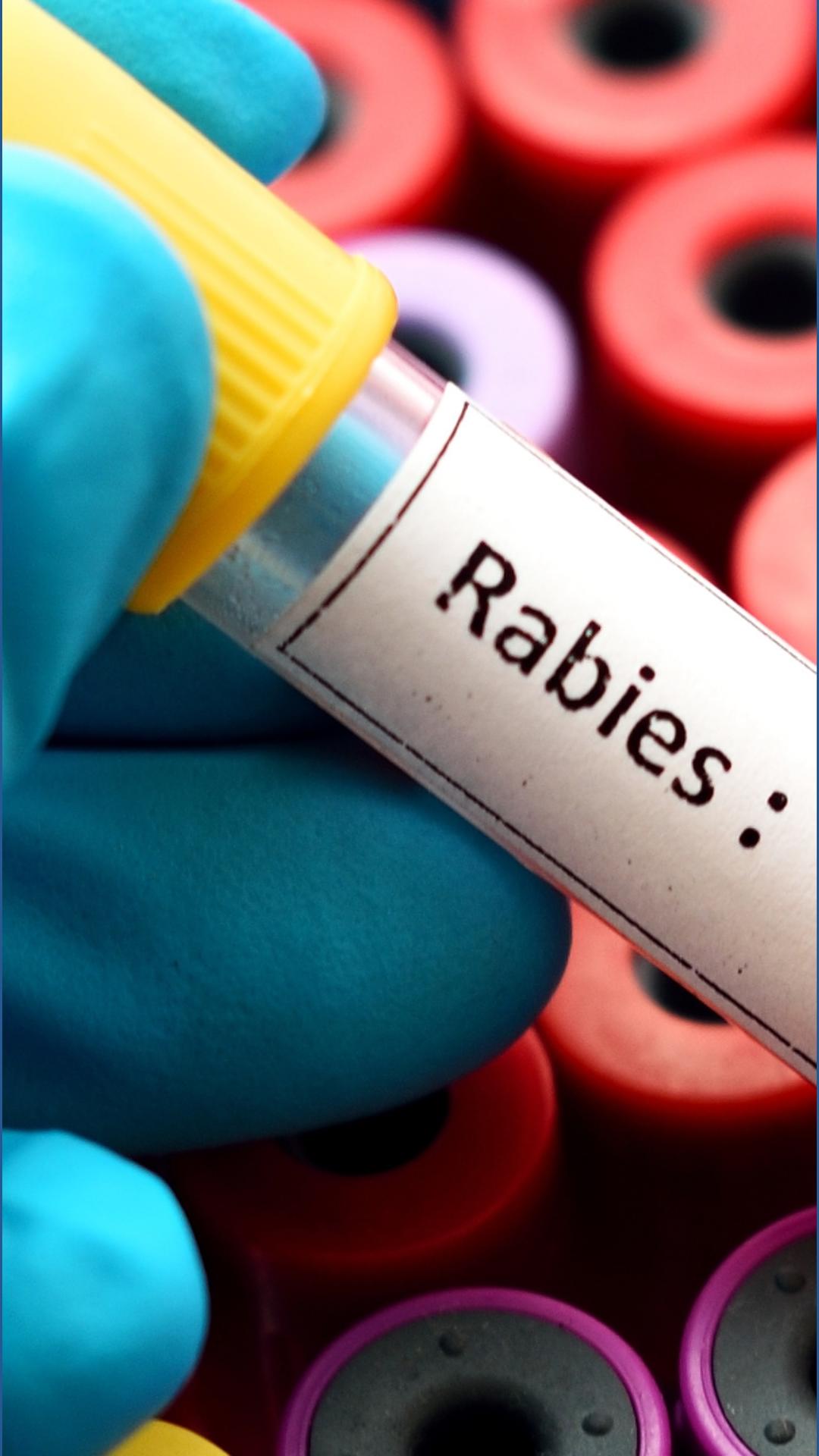 Michigan man died from rabies traced to infected kidney from Idaho ...