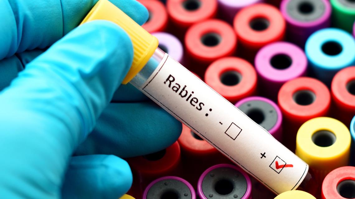 Michigan man died from rabies traced to infected kidney from Idaho donor