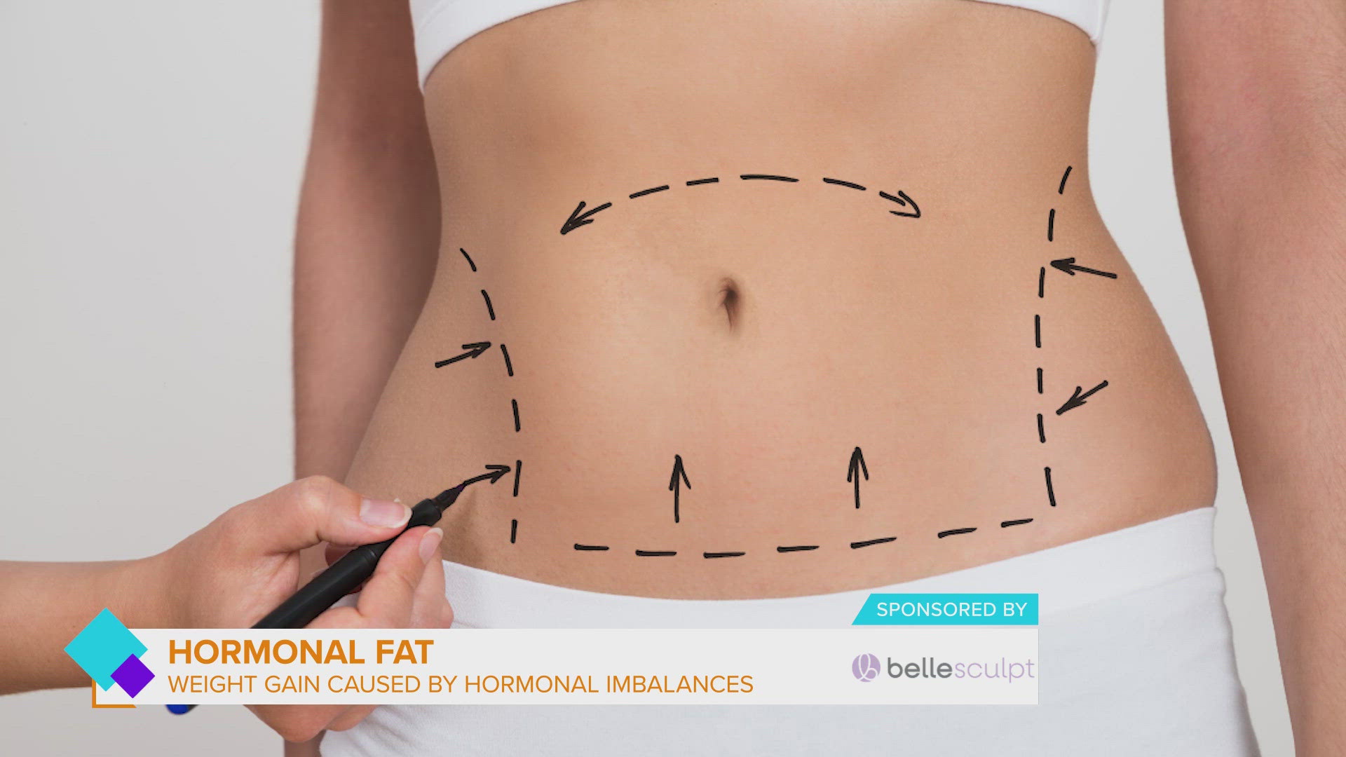 BelleSculpt specializes in removing "stubborn" fat