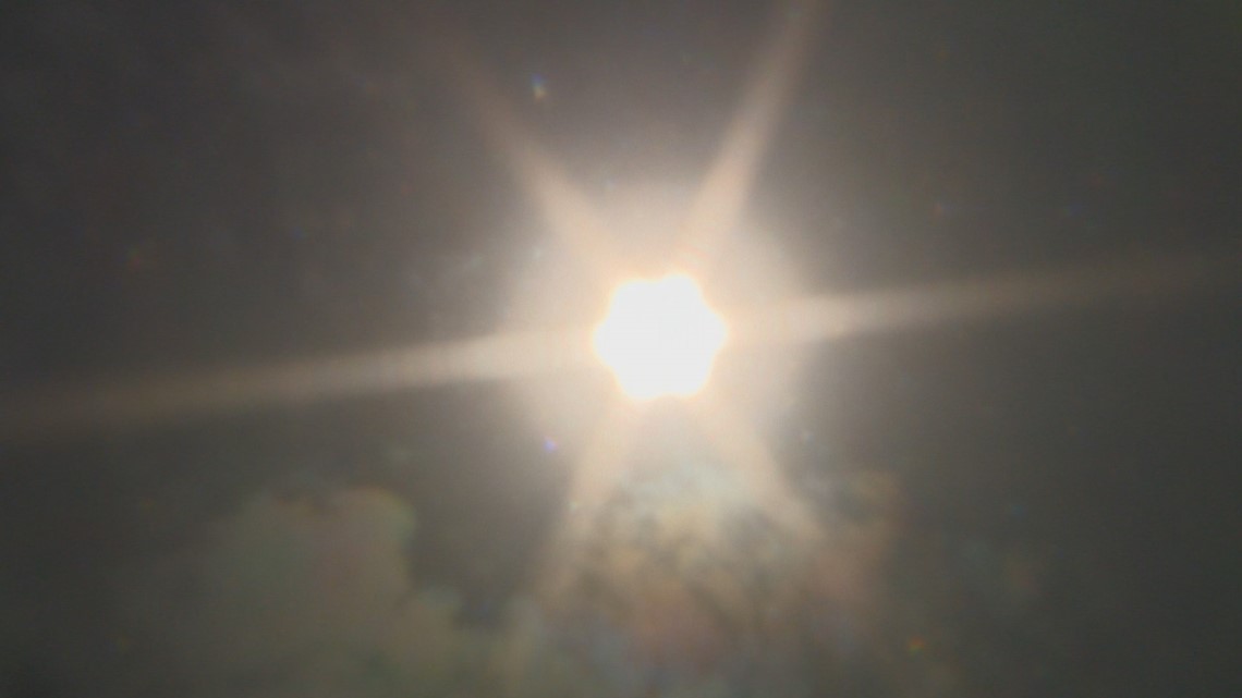 Idaho’s skin cancer rate among the highest in U.S.