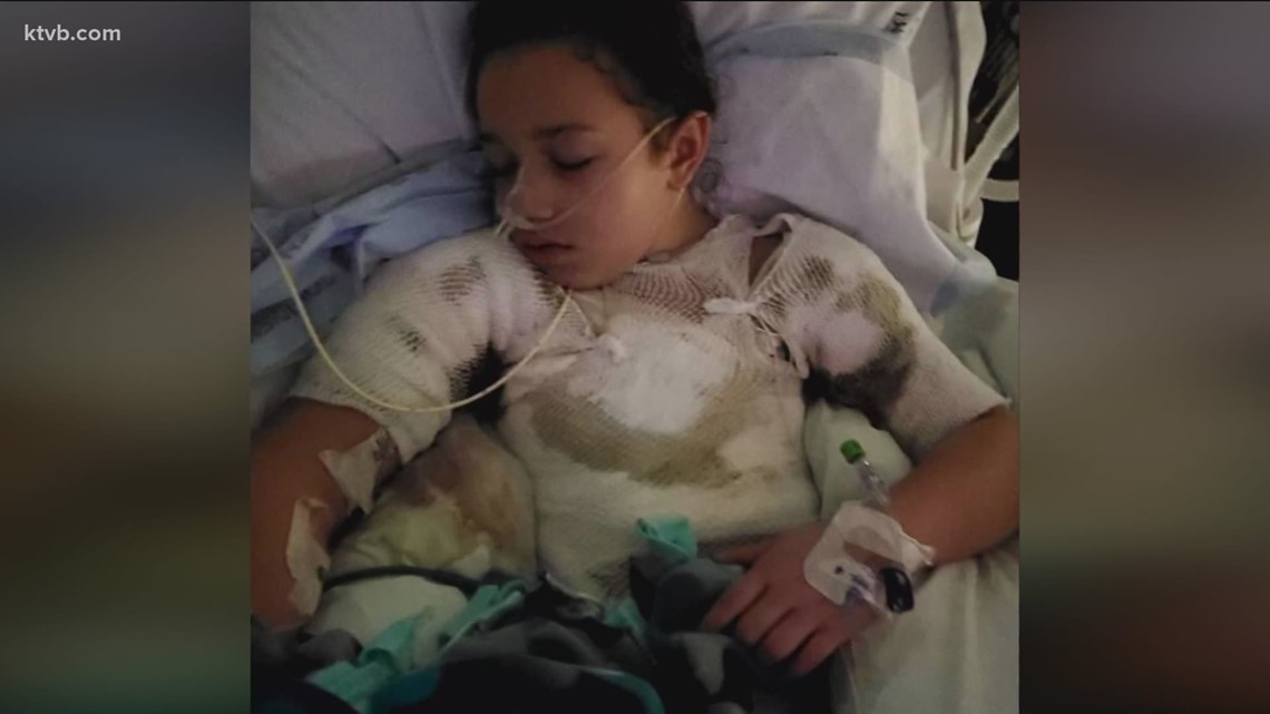 Mountain Home girl burned by candle fire wants everyone to know they're