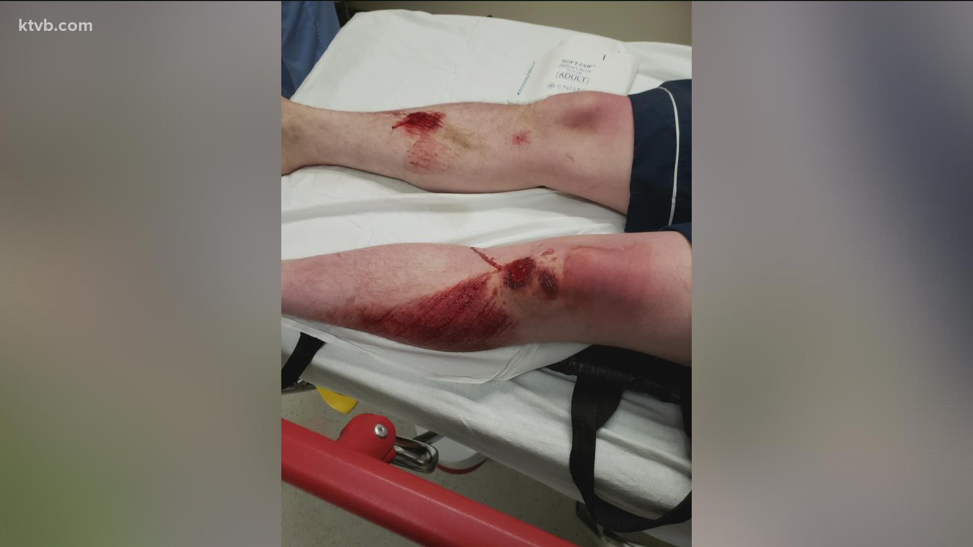 McCall Fire and EMS said this summer alone they've responded to as many injuries from the cliffs at Payette Lake as they have in the last two decades.