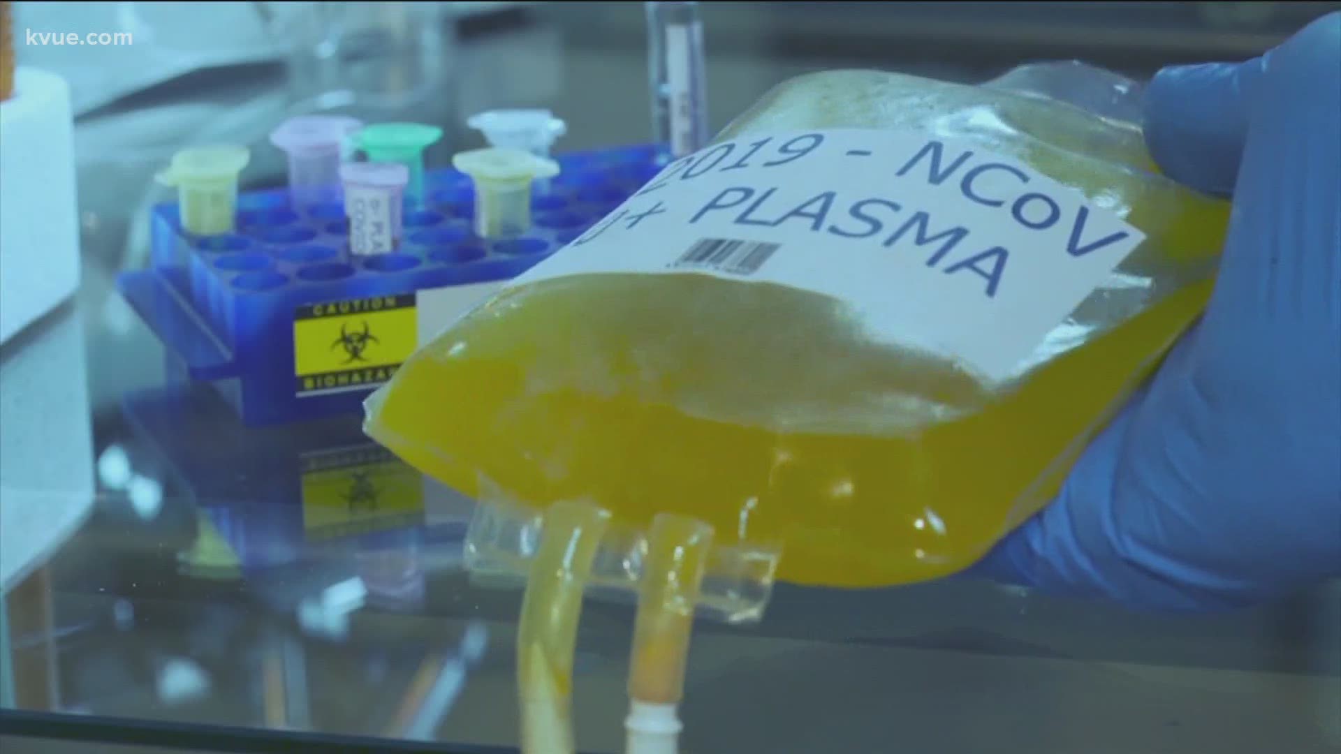 COVID-19 convalescent plasma therapy is safe, study finds | ktvb.com