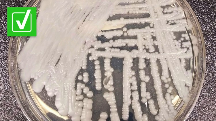 Yes, a drug-resistant fungus is spreading in U.S. health care facilities