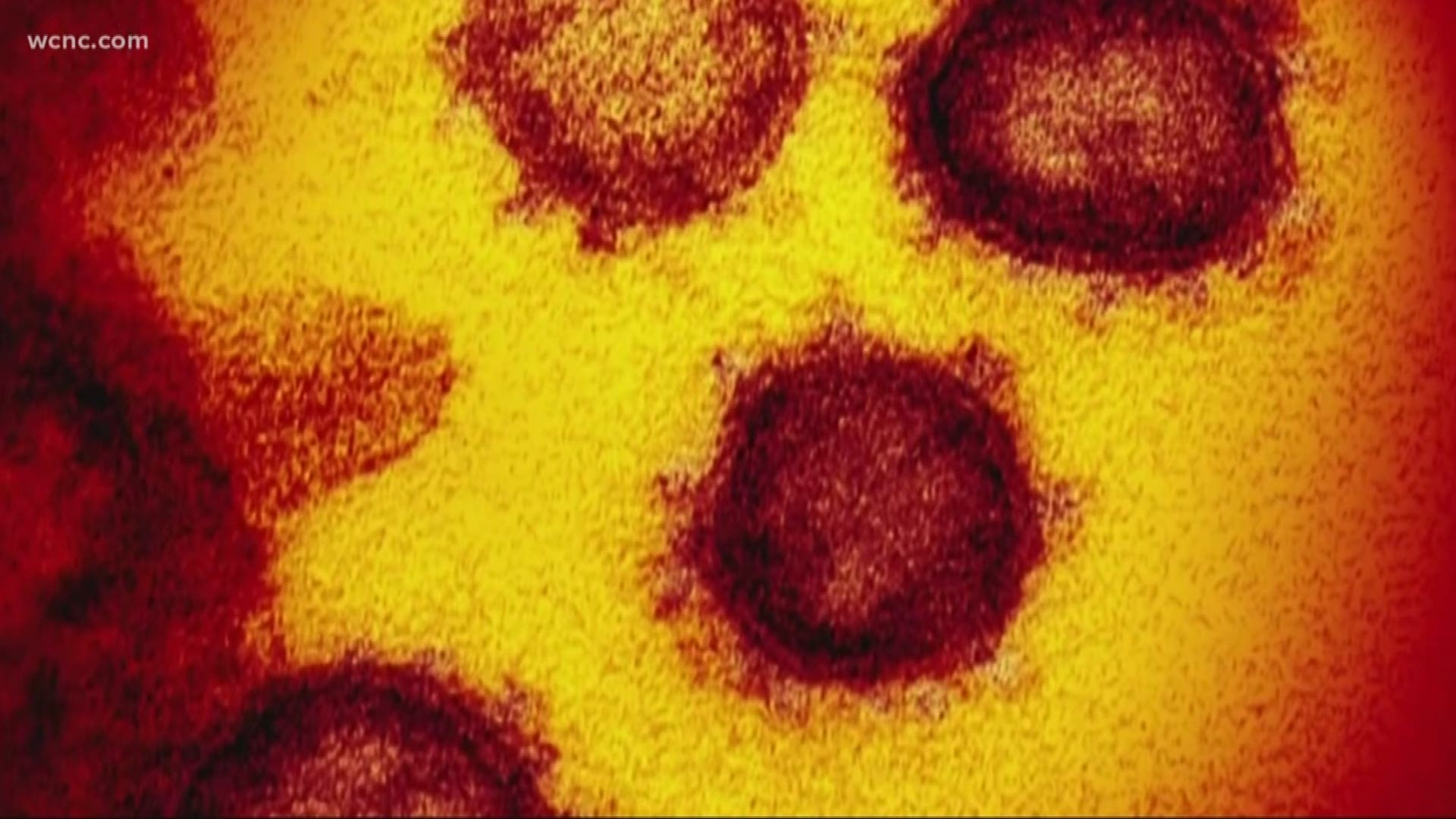 North Carolina has its first presumptive case of coronavirus, Governor Roy Cooper announced Tuesday afternoon.