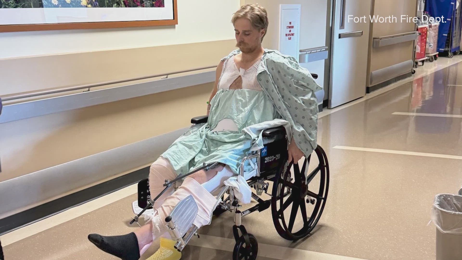 A Fort Worth firefighter is battling through devastating injuries, multiple surgeries, and the pain of being separated from his newborn son.